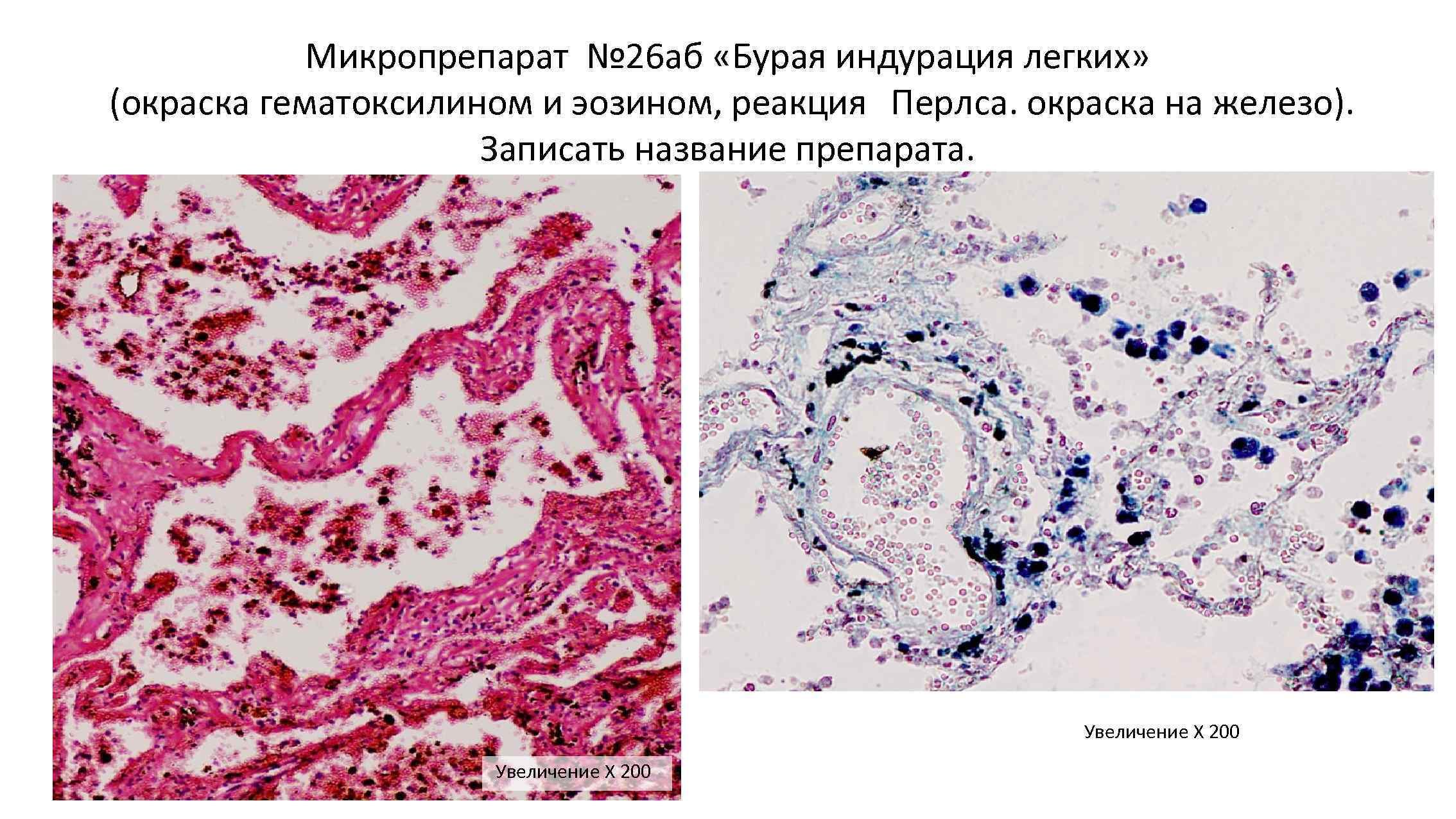 . Титлянов, . Титлянова МОРСКИЕ