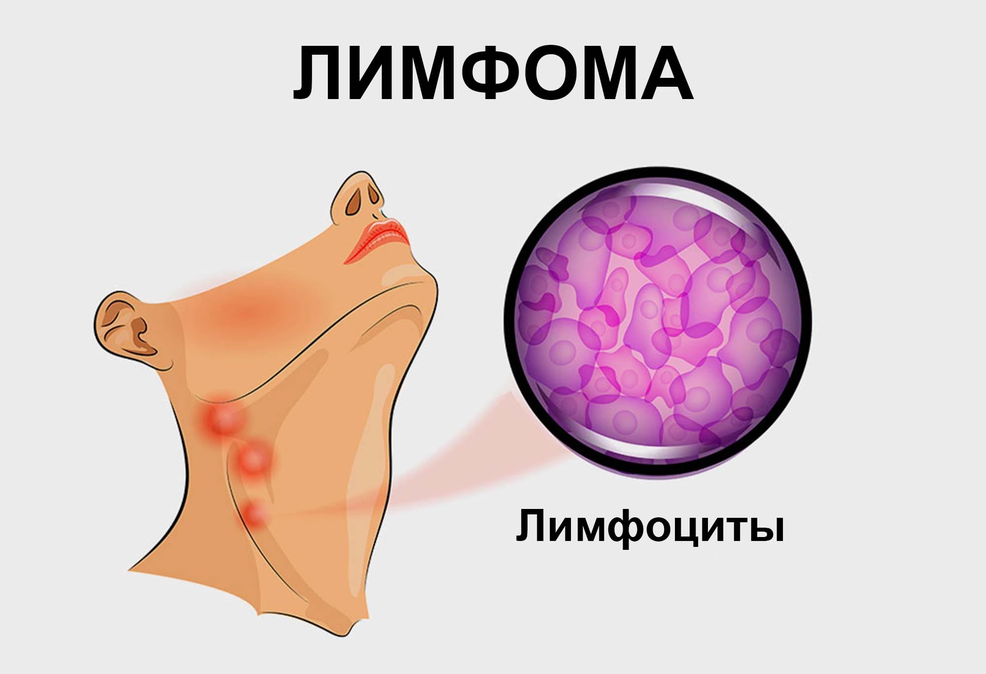 Ничего, ничего не бойся Ни огня, ни звенящую тень Утром