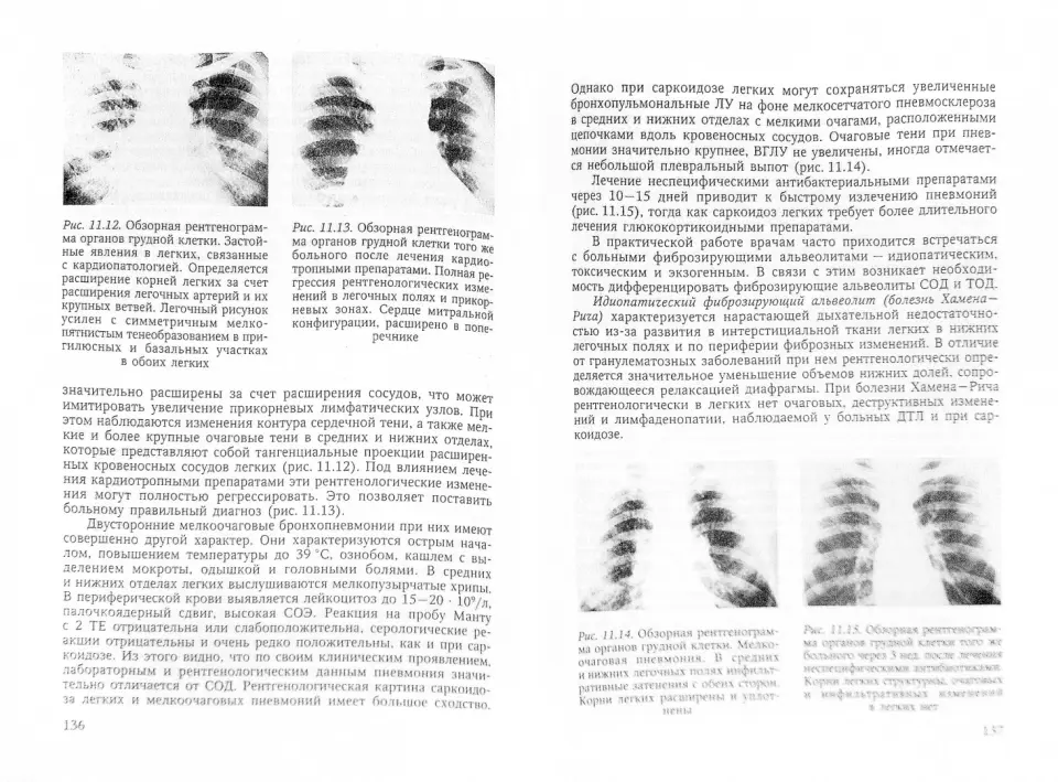 Рентгенография в диагностике заболеваний органов грудной клетки