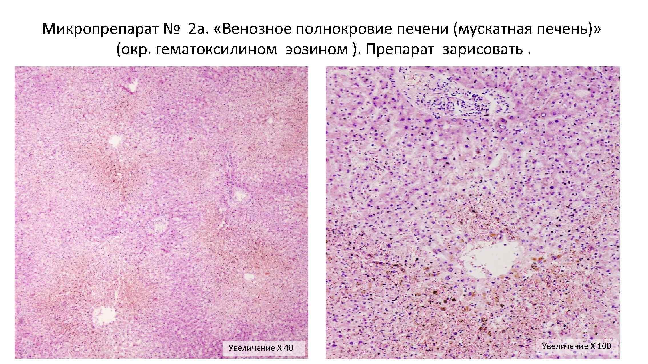 Мускатная печень рисунок 