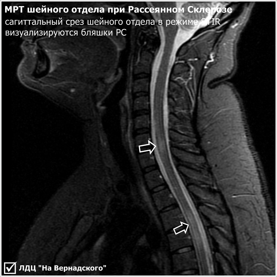 Рисунок головного мозга