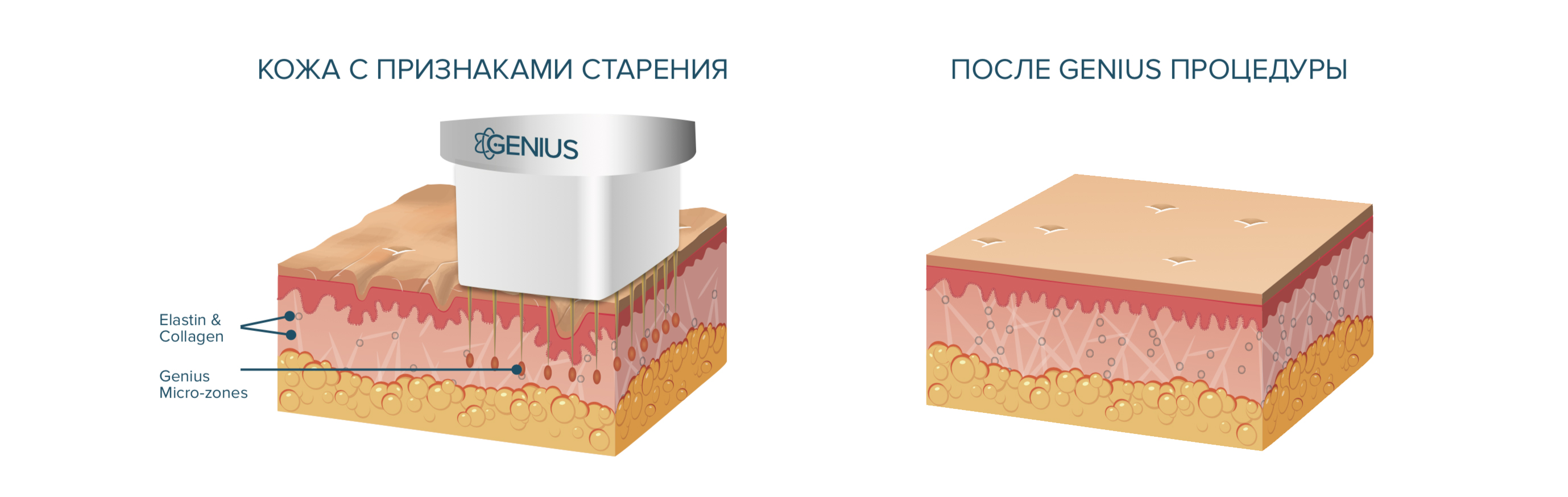 Арт