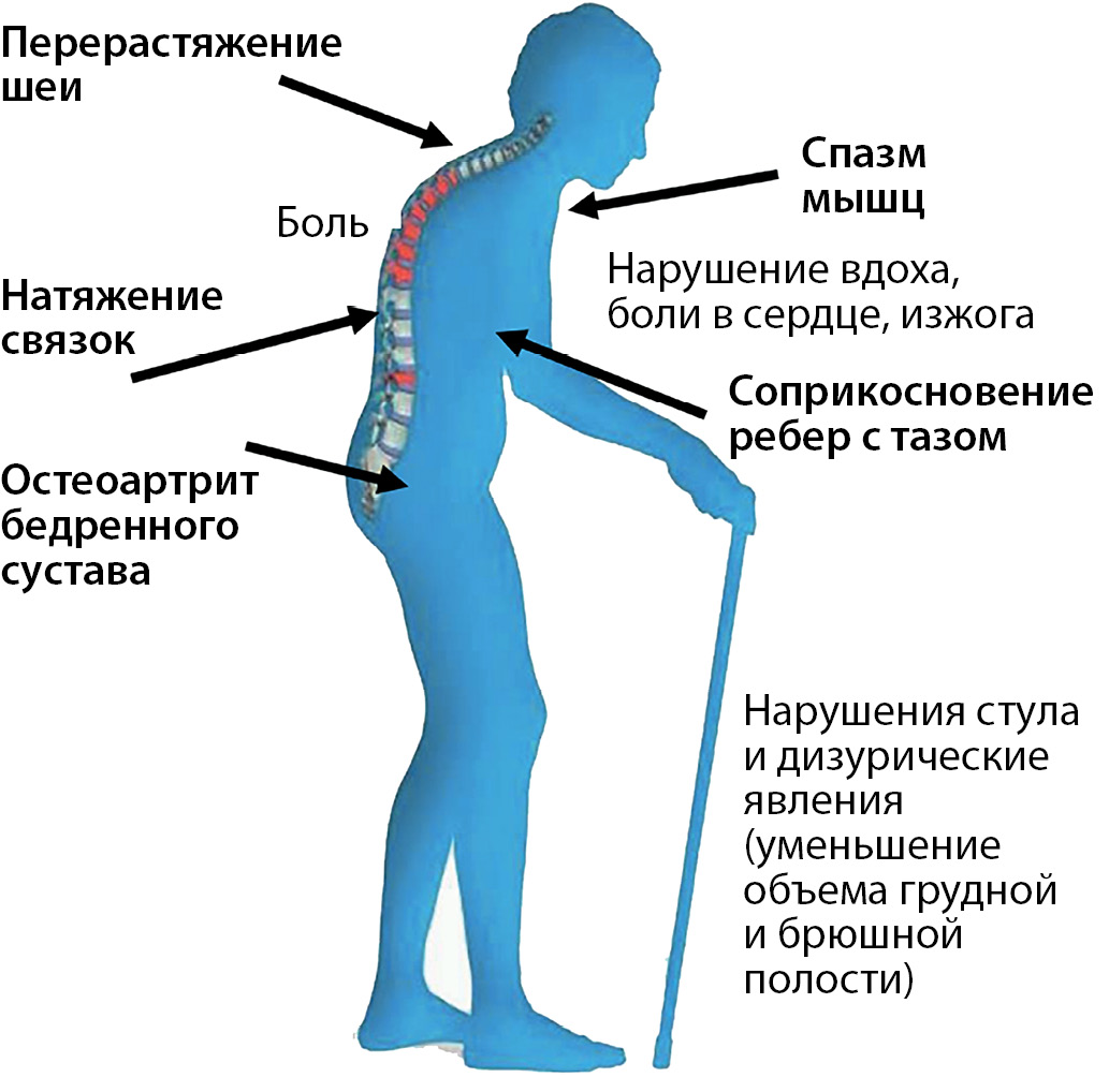 На рисунке цифрами 123 обозначены