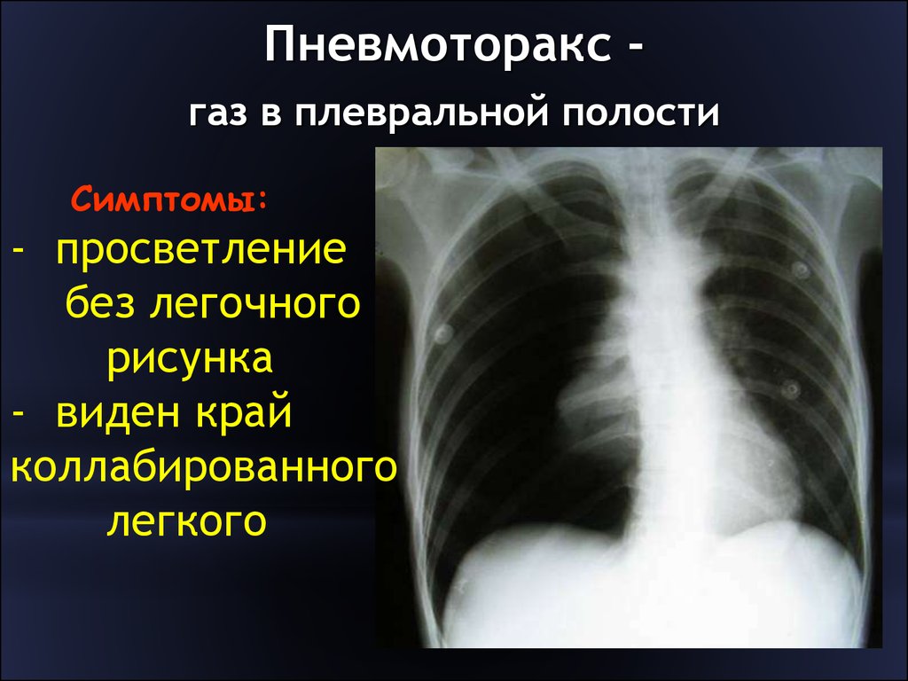 Презентация АНАЛИЗ ОБЗОРНОЙ